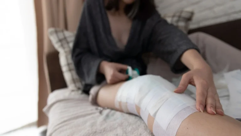rehabilitacja acl